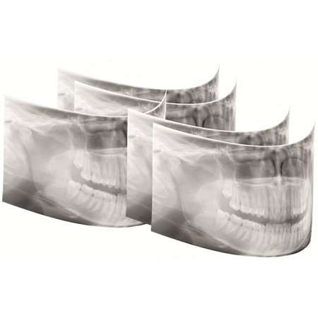 KaVo Pan eXam Plus 3D Ceph (2 датчика) - универсальный датчик Pan/Ceph для панорамной томографии, цефалостат, функция 3D-томографии 6x8 см