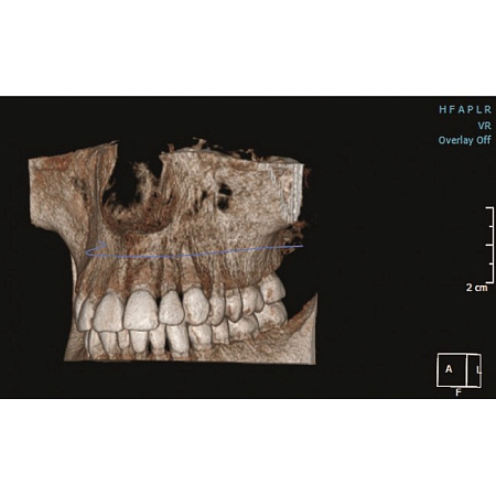 KaVo Pan eXam Plus 3D - цифровая панорамная рентгенодиагностическая система с функцией 3D-томографии 6x8 см и возможностью дооснащения модулем цефалостата